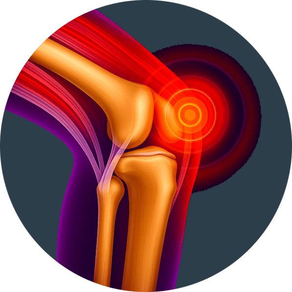 Infiammazione articolare