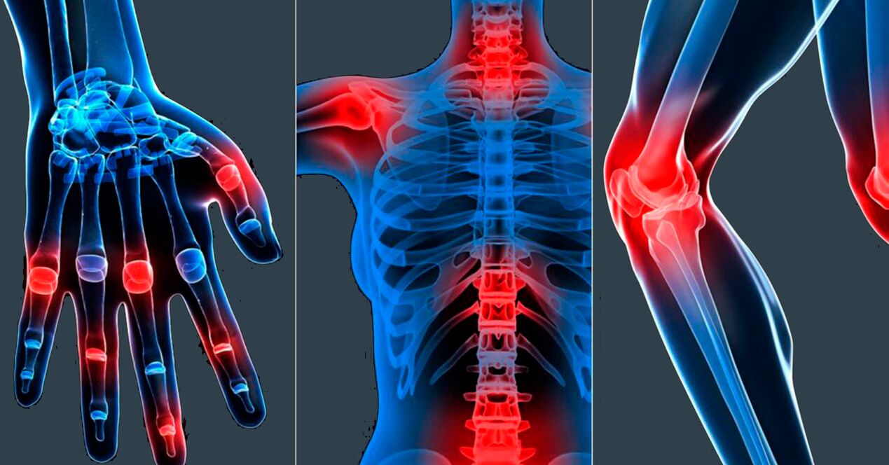 Istruzioni per l'uso dell'estratto di boswellia in capsule